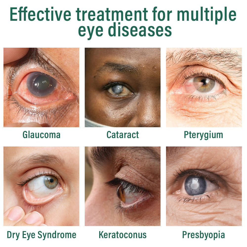 👩⚕️Bazenith™ Nano Eye Drops Serum ✅FDA Approved(Suitable for presbyopia, dry eye syndrome, glaucoma, and cataracts) 🌷