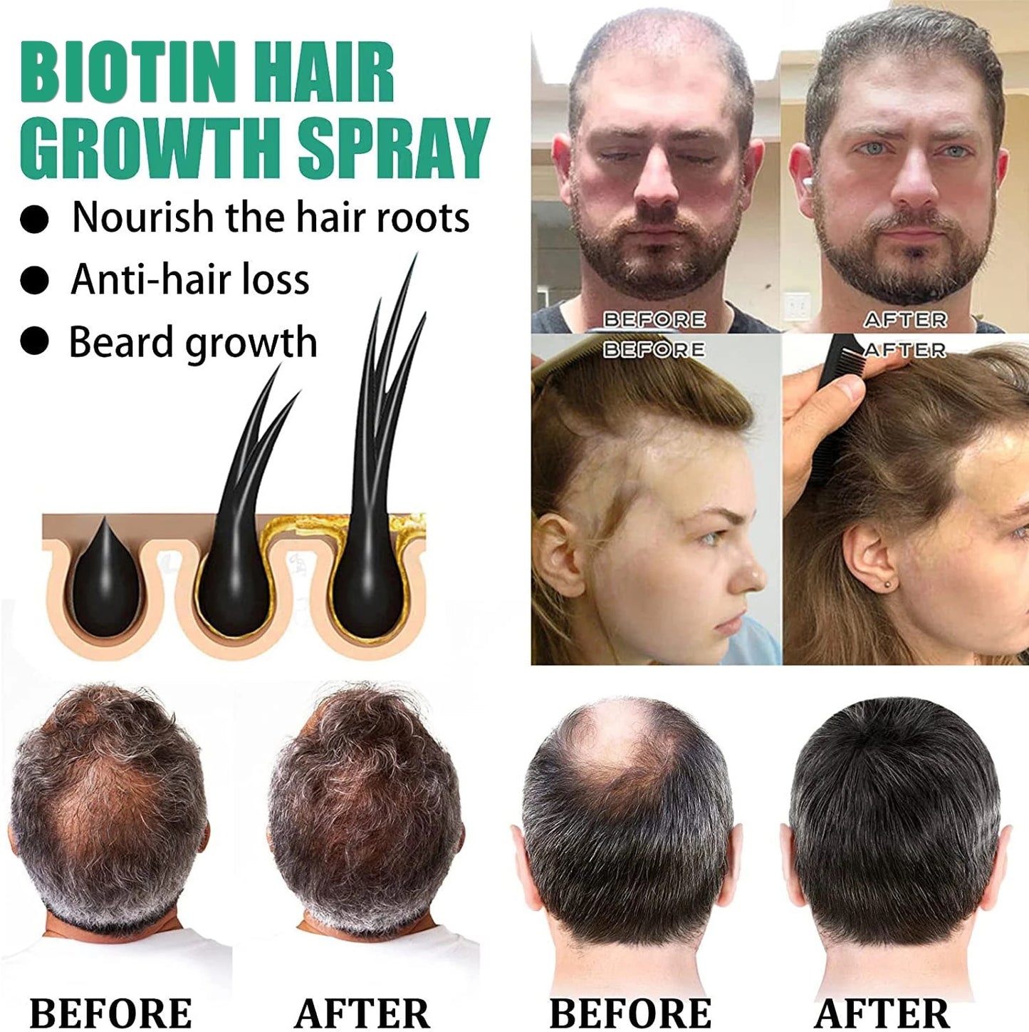 Bloobeac®Hair Growth Serum - Strong and Healthy Hair, Nutritious, Anti-Hair Loss, Moisturizing Root, Dense Scalp, Massage Nutrition