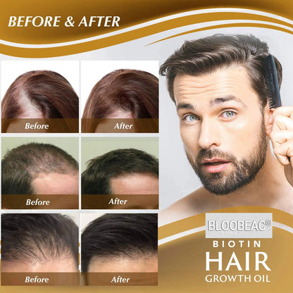Bloobeac®Hair Growth Serum - Strong and Healthy Hair, Nutritious, Anti-Hair Loss, Moisturizing Root, Dense Scalp, Massage Nutrition