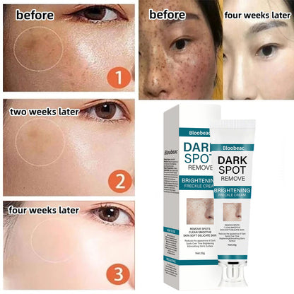 [Official Store] Bloobeac® Blemish Removing Beauty Cream – Fades Dark Spots, Freckles & Wrinkles | Age-Defying, Even-Tone Treatment
