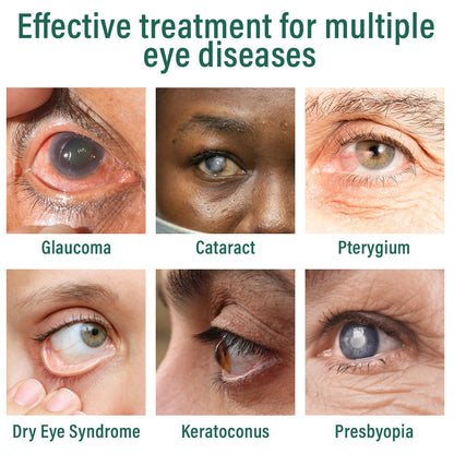 👩‍⚕️Bazenith™ Nano Eye Drops Serum ✅FDA Approved(Suitable for presbyopia, dry eye syndrome, glaucoma, and cataracts) 🌷