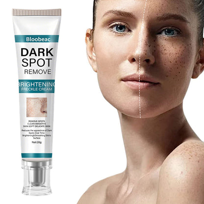 [Official Store] Bloobeac® Blemish Removing Beauty Cream – Fades Dark Spots, Freckles & Wrinkles | Age-Defying, Even-Tone Treatment