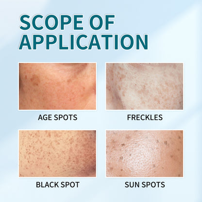 [Official Store] Bloobeac® Blemish Removing Beauty Cream – Fades Dark Spots, Freckles & Wrinkles | Age-Defying, Even-Tone Treatment