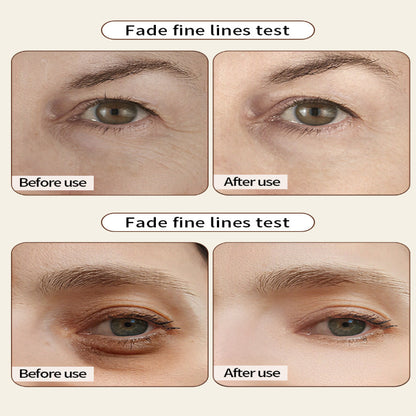 🔥[Official Store]🔥 Bloobeac® Eye care patches | Visibly Tighter in 15 Mins. Lasts All Day.