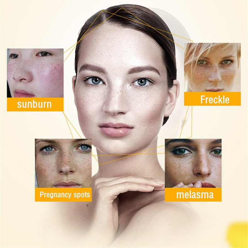 [Official Store] Bloobeac® Blemish Removing Beauty Cream – Fades Dark Spots, Freckles & Wrinkles | Age-Defying, Even-Tone Treatment