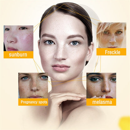 [Official Store] Bloobeac® Blemish Removing Beauty Cream – Fades Dark Spots, Freckles & Wrinkles | Age-Defying, Even-Tone Treatment