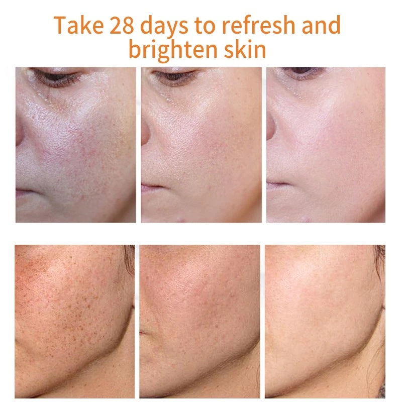 [Official Store] Bloobeac® Blemish Removing Beauty Cream – Fades Dark Spots, Freckles & Wrinkles | Age-Defying, Even-Tone Treatment