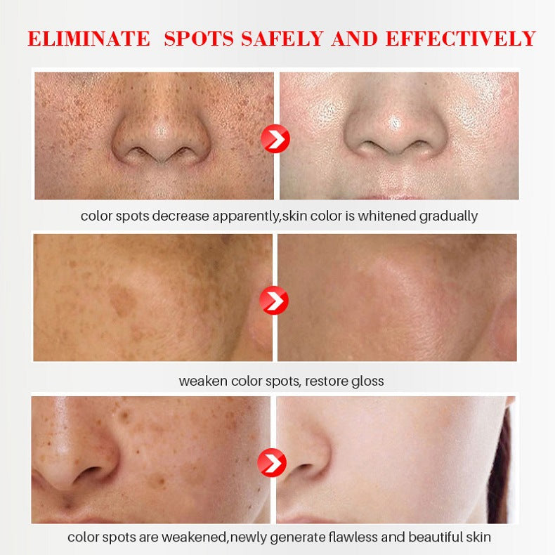 [Official Store] Bloobeac® Blemish Removing Beauty Cream – Fades Dark Spots, Freckles & Wrinkles | Age-Defying, Even-Tone Treatment
