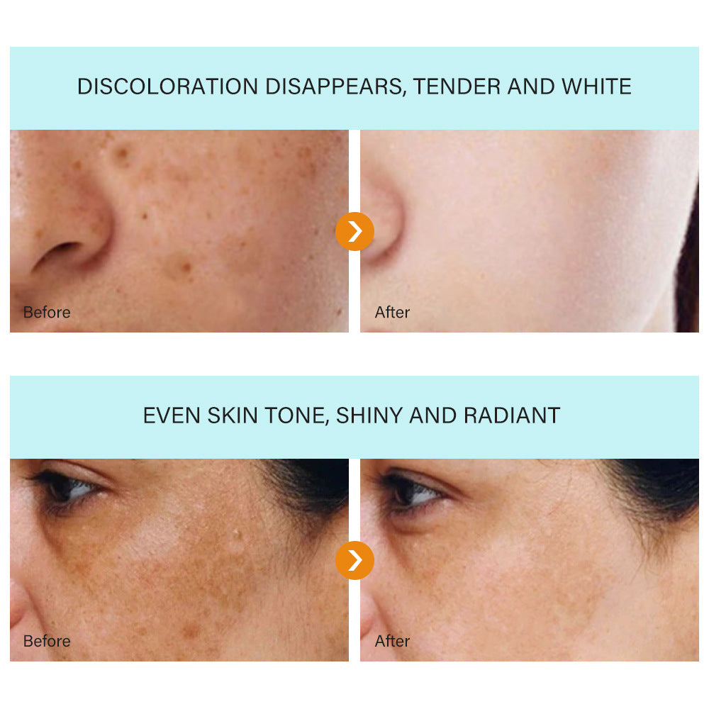 [Official Store] Bloobeac® Blemish Removing Beauty Cream – Fades Dark Spots, Freckles & Wrinkles | Age-Defying, Even-Tone Treatment